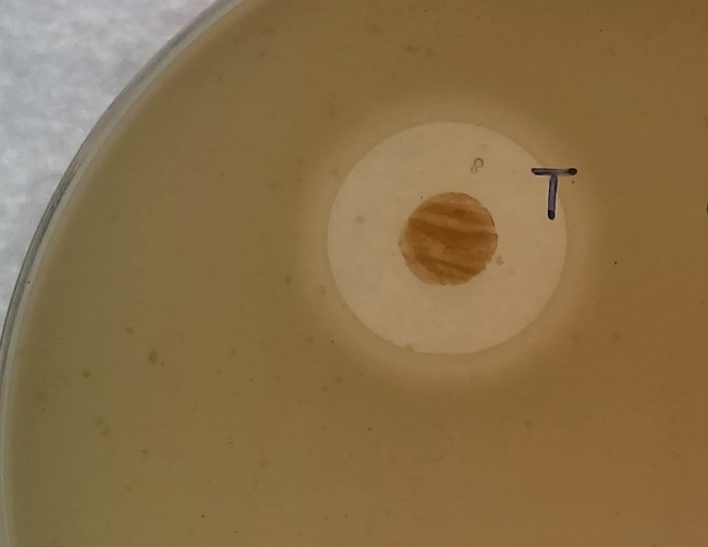 Vi khuẩn Streptomyces sp. Myrophorea trong ảnh là chấm mầu nâu sẫm, còn vầng sáng bao quanh là tụ cầu vàng kháng methicillin  bị ngăn chặn - Ảnh: Đại học Swansea
