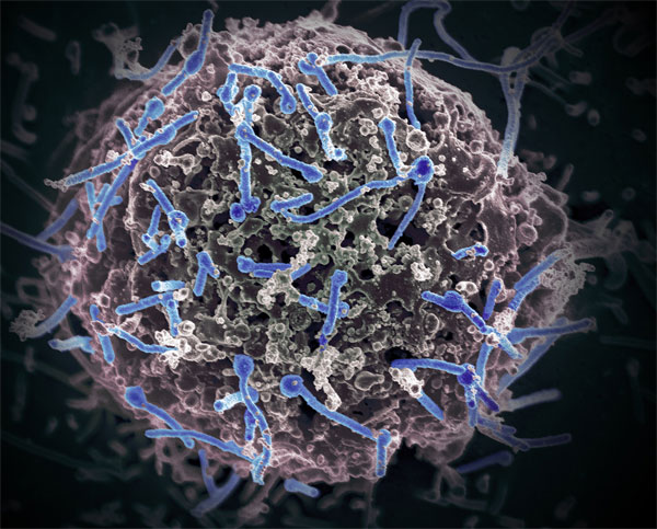Đây là lần đầu tiên lại virus này được phát hiện trong một loài dơi sống ở khu vực Tây Phi.