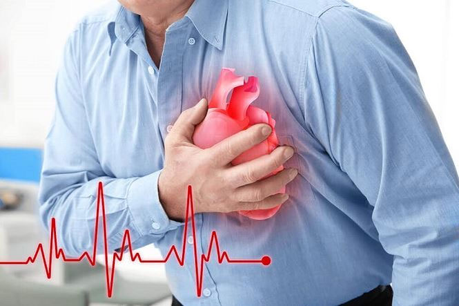Bệnh tim mạch là nguyên nhân gây tử vong hàng đầu ở những nước phát triển.