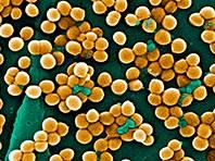 Sự hiện diện của vi khuẩn Staphylococcus aureus  làm tăng nguy cơ phát triển dị ứng với lạc, trứng và sữa bò - Ảnh: Wikipedia.org