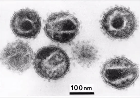 Virus có kích thước cực kỳ nhỏ, chỉ dài từ vài chục cho tới vài trăm nanomet.
