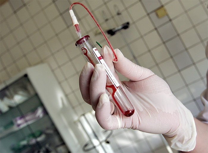 Xét nghiệm máu để phát hiện virus HIV