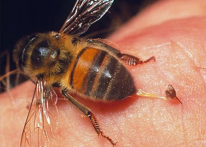 Vết thương khi bị ong đốt