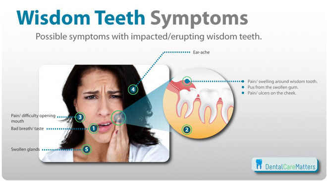 Những chiếc răng này thường chỉ xuất hiện vào lúc con người khoảng 17-25 tuổi.