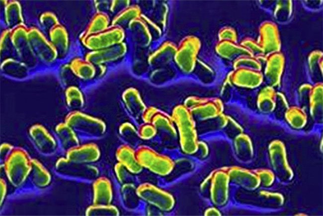 Vi khuẩn gây bệnh dịch hạch Yersinia pestis
