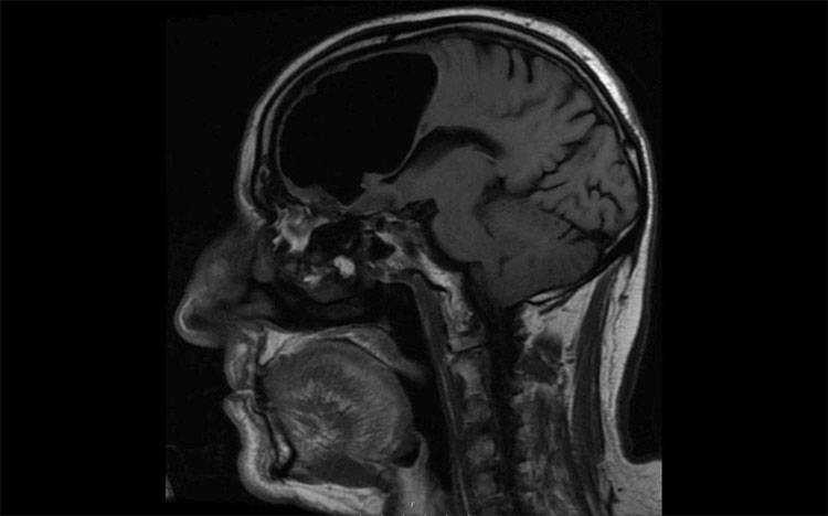 Hình ảnh chụp cộng hưởng từ MRI.