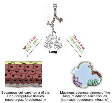 Tế bào ung thư phổi có thể biến thành tế bào cơ quan khác, để kháng thuốc đặc trị ung thư phổi.