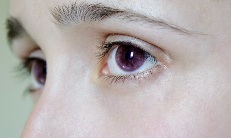 Bạn đã từng thấy ai với đôi mắt tím như thế này hay chưa?