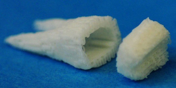 Công nghệ mới này cho phép chúng ta mọc lại chiếc răng đã mất chỉ sau 9 tuần.