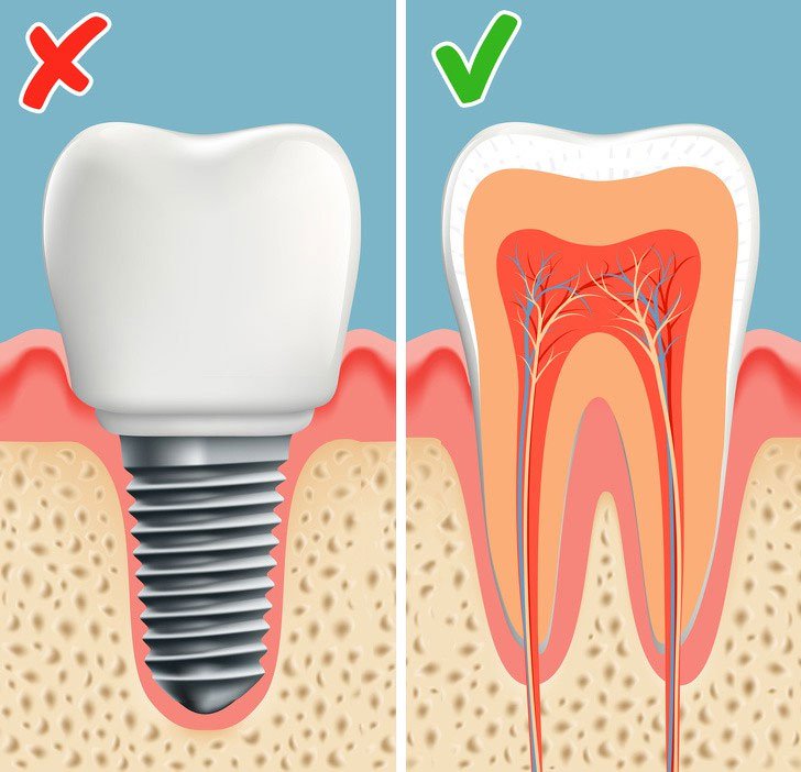 Răng được tái tạo ngay trong miệng, người được cấy sẽ tốn ít thời gian để hồi phục hơn.