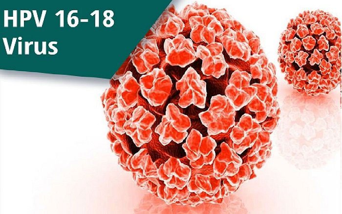 Nhiễm Human Papilloma virus (HPV) là 1 trong 4 STD không thể chữa khỏi.