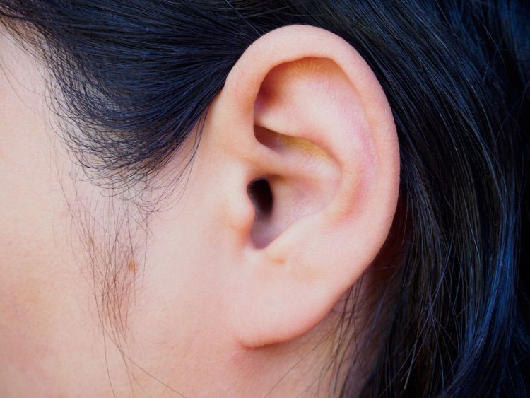 RSHL tương đối hiếm gặp với tỷ lệ một trên 12.000 trường hợp mất thính lực. 