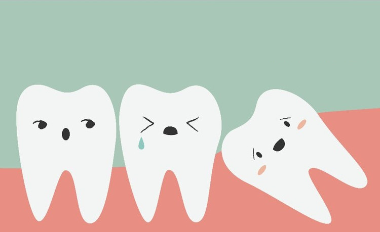 Nếu răng khôn chung sống bình yên với những chiếc răng khác thì bạn không cần phải nhổ nó làm gì.