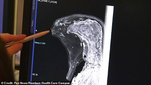 Ảnh chụp CT cho thấy đây nhiều khả năng là đầu một con chim ưng