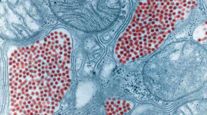 Hình ảnh trên kính hiển vi này cho thấy tuyến nước bọt của muỗi bị nhiễm virus EEE (màu đỏ).