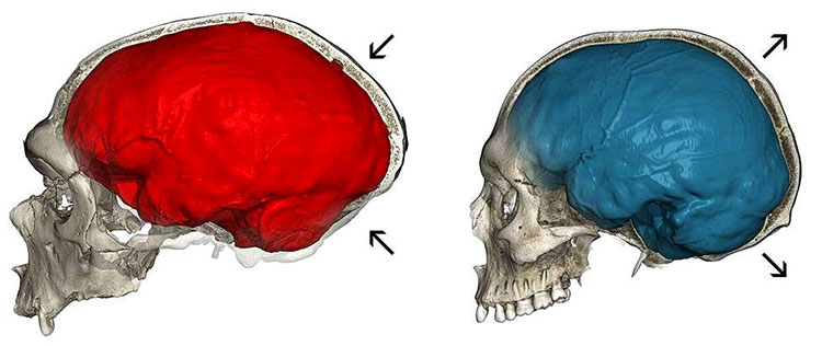 Não của người Neanderthal  bị bẹp so với não chúng ta (màu xanh)