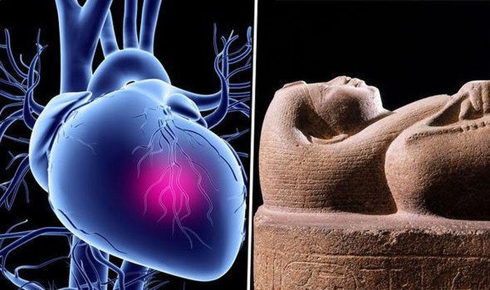 Người cổ đại có các động mạch bị tắc nhiều hơn so với chúng ta từng biết