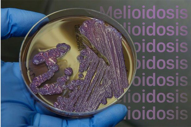 Melioidosis là một bệnh nhiễm trùng do vi khuẩn.