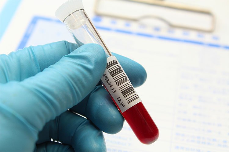 Chỉ số bạch cầu mono trong xét nghiệm máu thường thay đổi tùy theo bệnh