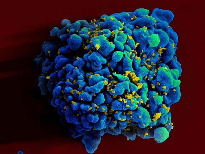 Hình ảnh quét màu của tế bào T dưới kính hiển vi.