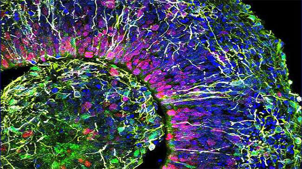 Ảnh hiển vi chụp một lát cắt của bộ não nhân tạo mini mà các nhà khoa học phát triển.