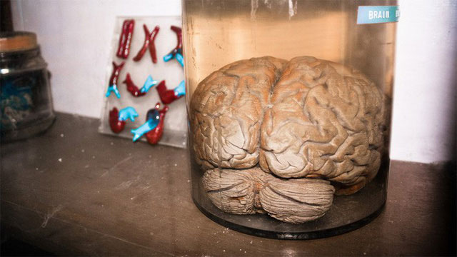 Các nhà khoa học luôn lo ngại những bộ não nhân tạo có ý thức. 