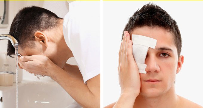 Cách sơ cứu khi mắt bị thương