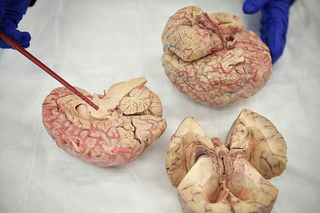 Ngân hàng não cho phép các nhà khoa học phân tích mô não người châu Á.