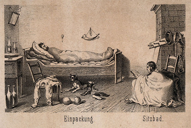 Một vài minh họa về thủy trị liệu trong thế kỷ XIX.