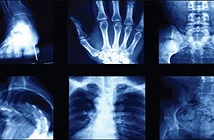 Giải mã 5 lời đồn oan trái về tia X-quang