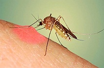 Tại sao bị muỗi đốt lại sưng và ngứa rất lâu?
